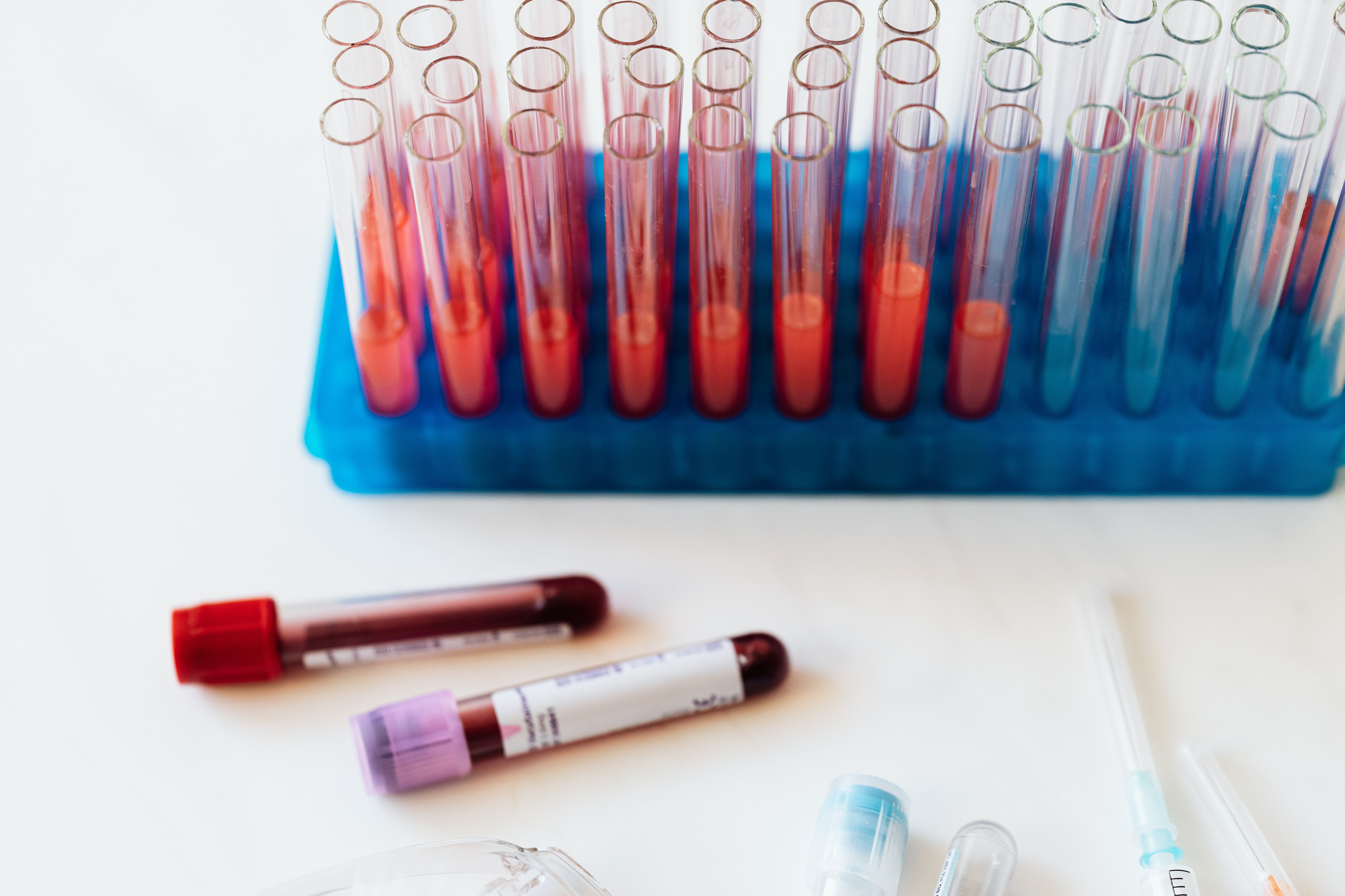 Electrophoresis Reagents Market Report 2023- Market Overview, Competitive Landscape & Forecast 2032