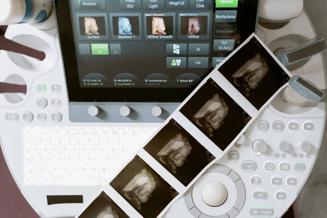 Artificial Intelligence in Medical Imaging Market 2024 - Industry Segments, Market Size, Share, Top Major Players, And Forecast To 2033