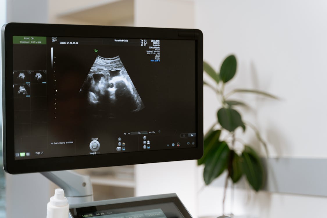 3D And 4D Ultrasound Devices Market 2024 - Market Analysis, Emerging Trends, Top Players, Key Drivers, And Forecast To 2033