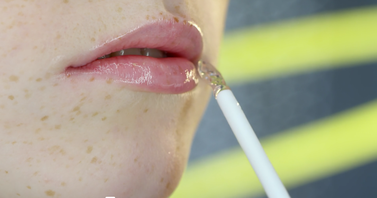 Lip Filler Costs and Financing Options: What You Need to Know