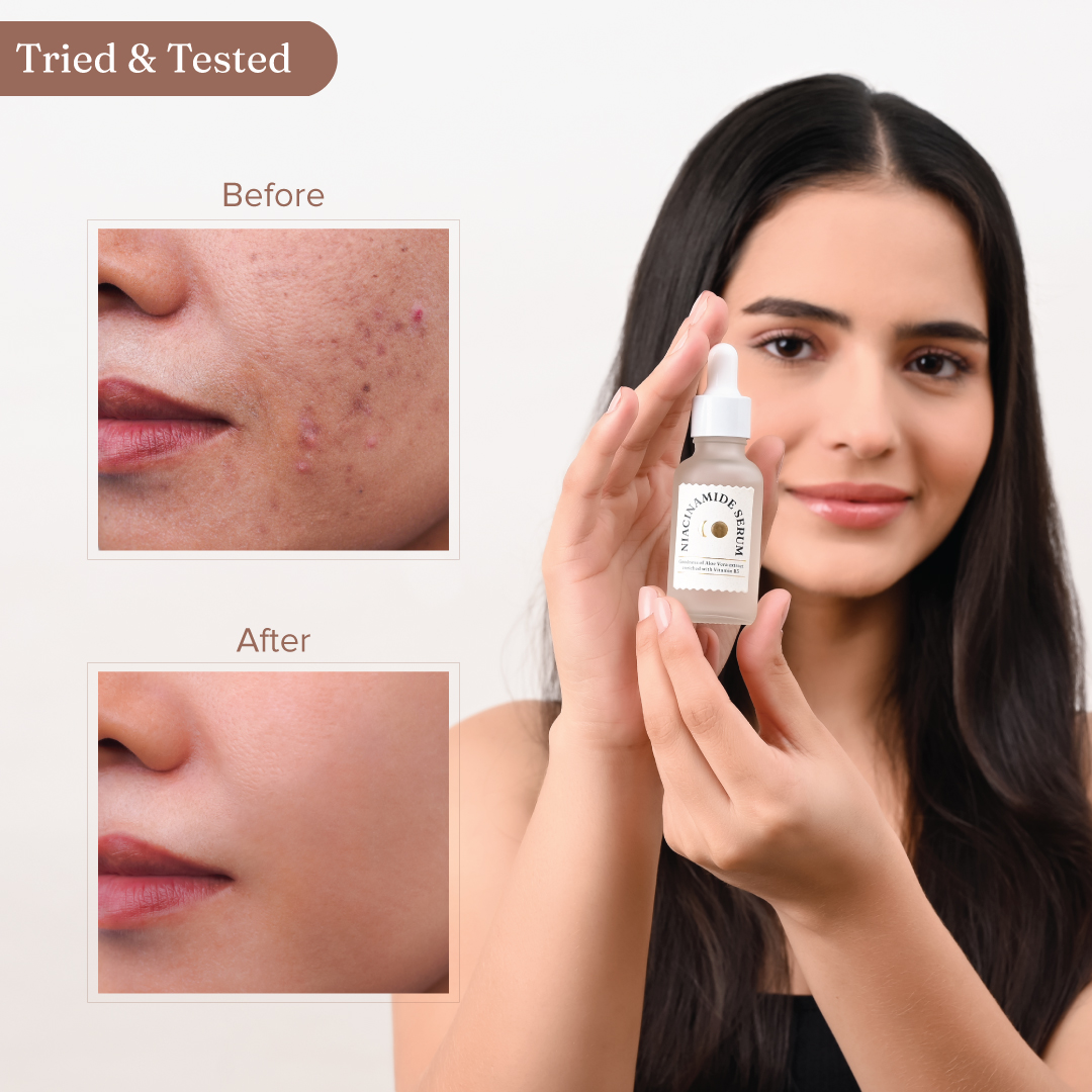 Niacinamide Serum: Best Face Serum by Dromen & Co