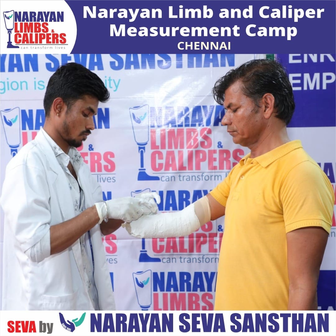 Free Artificial Limb Distribution in USA