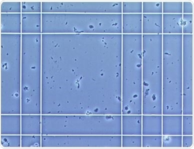 Cell Counting Market Analysis Report By Key Players - Merck Millipore, GE Healthcare, Thermo Fisher Scientific, PerkinElmer - Global Forecast