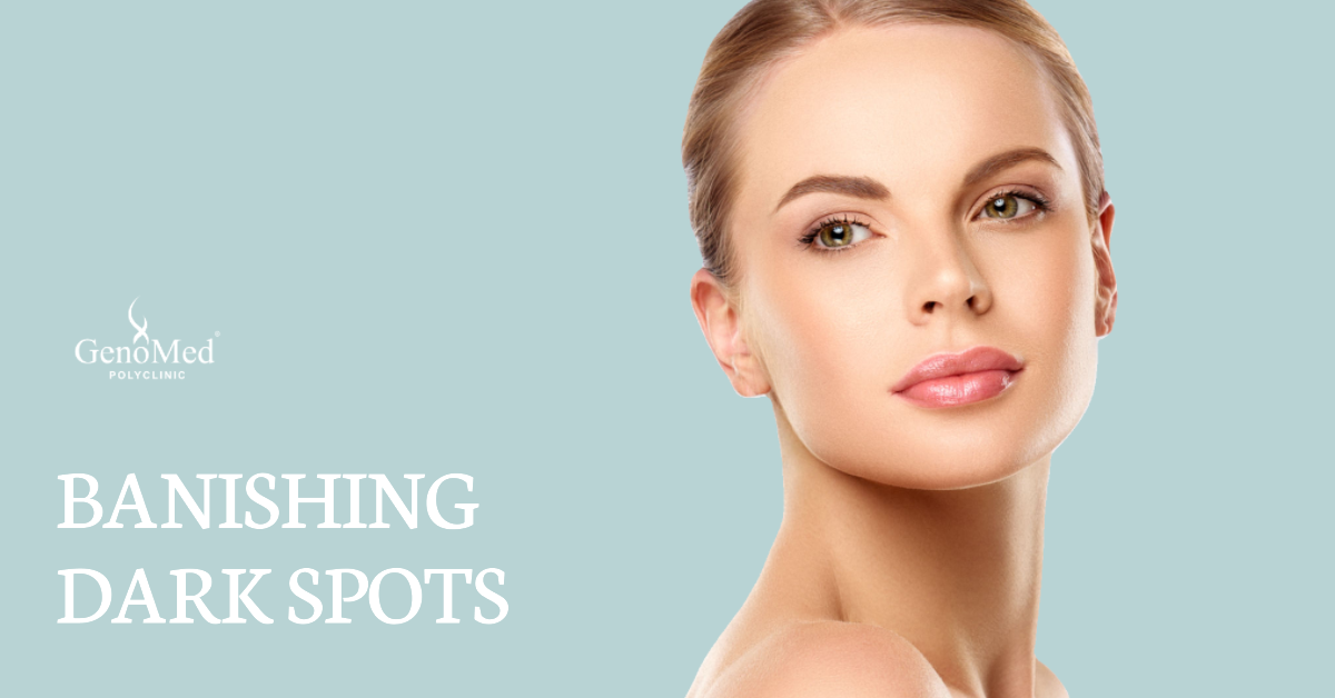Banishing Dark Spots: Evidence-Based Treatments for a Flawless Complexion
