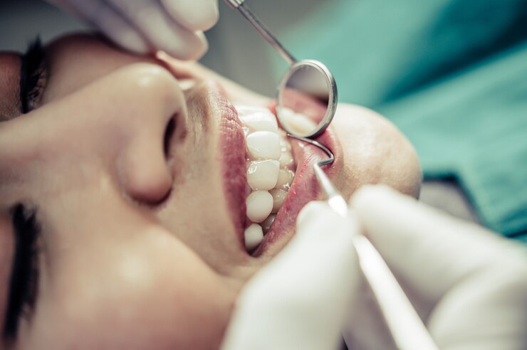 The Different Types of Tooth Fillings: Which One is Best for You?