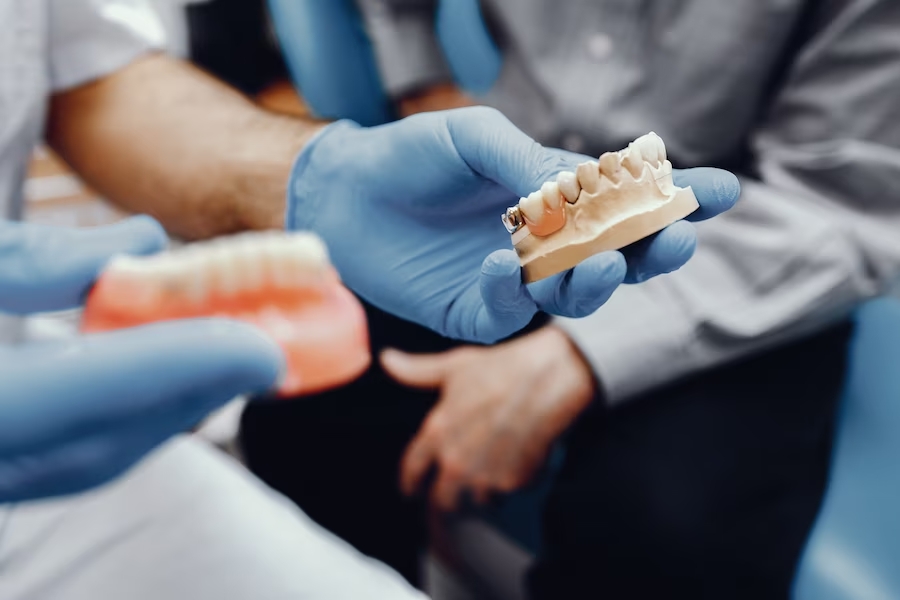 What Steps Are Required in Getting a Dental Bridge?