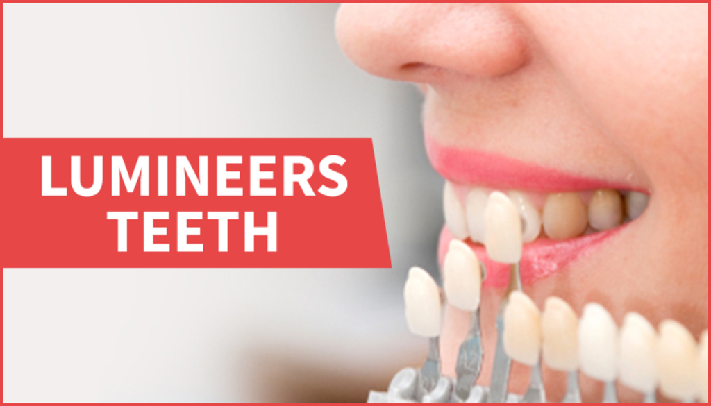 Six Possible Lumineers Teeth Side-effects