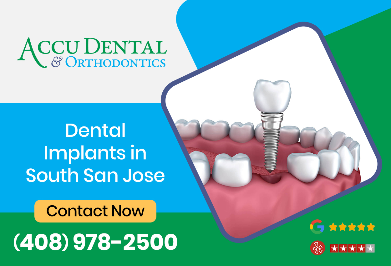 Dentist in South San Jose | Accu Dental & Orthodontics