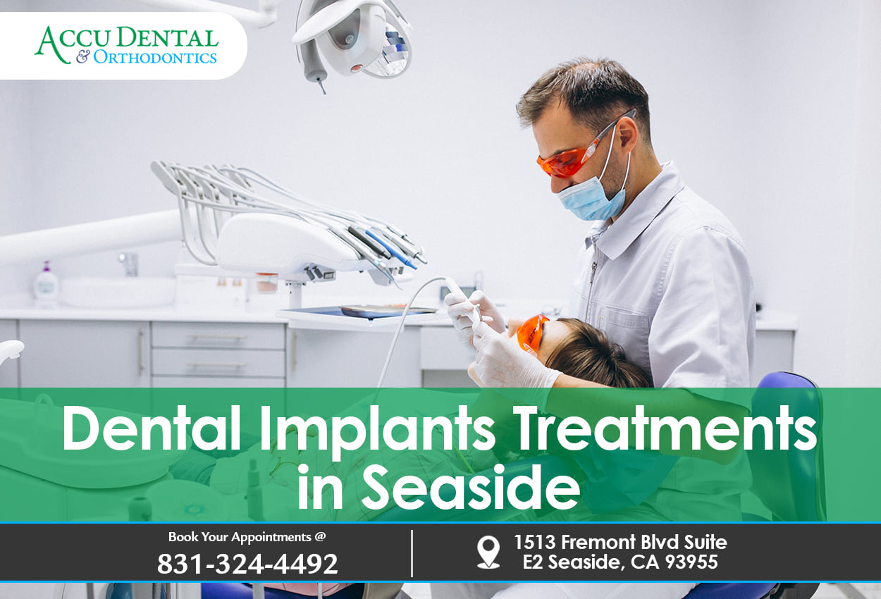 Implant dentist in Seaside | Accu Dental & Orthodontics