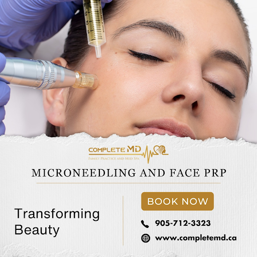 5 Reasons to Choose Complete MD for Morpheus Treatment in Mississauga