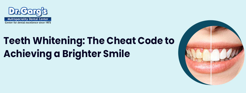 Teeth Whitening: The Cheat Code to Achieving a Brighter Smile