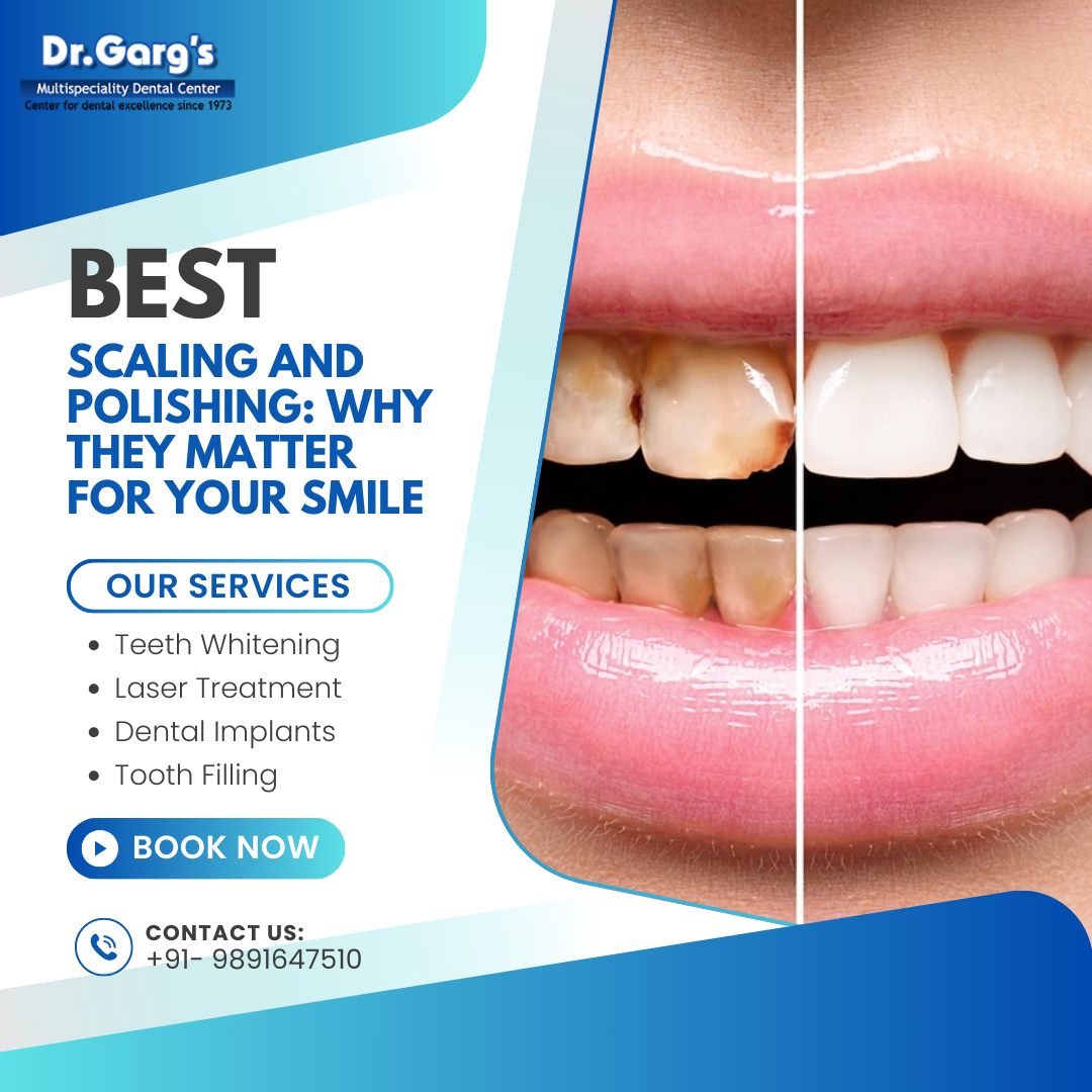 Scaling and Polishing: Why They Matter for Your Smile