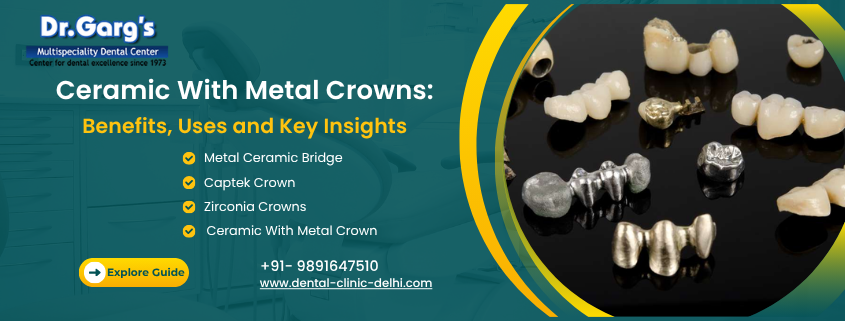 Ceramic with Metal Crown: Durable and Reliable Dental Solution