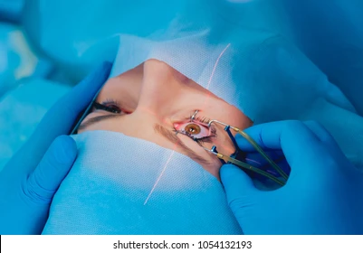 Glaucoma Research: Latest Developments