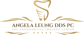Tips for Choosing the Best Implant Dentist for You