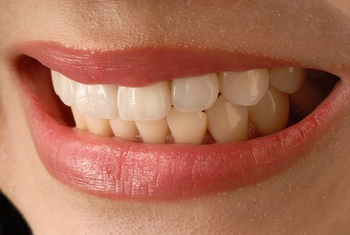 Top 5 Treatments Included in a Smile Makeover