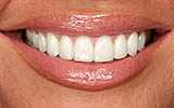 How to Effectively Treat Periodontal Disease