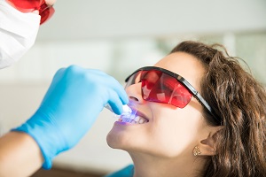 Zoom Teeth Whitening The Colony: A Quick and Effective Solution for a Dazzling Smile