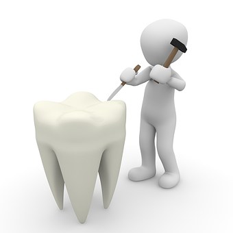Porcelain Veneers: The Secret to a Hollywood Smile