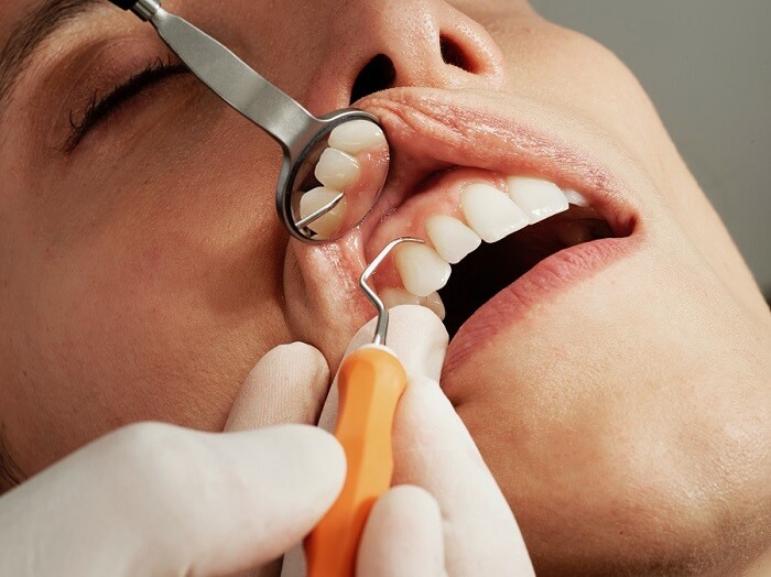 How to Choose the Best Cosmetic Dentist for You? 