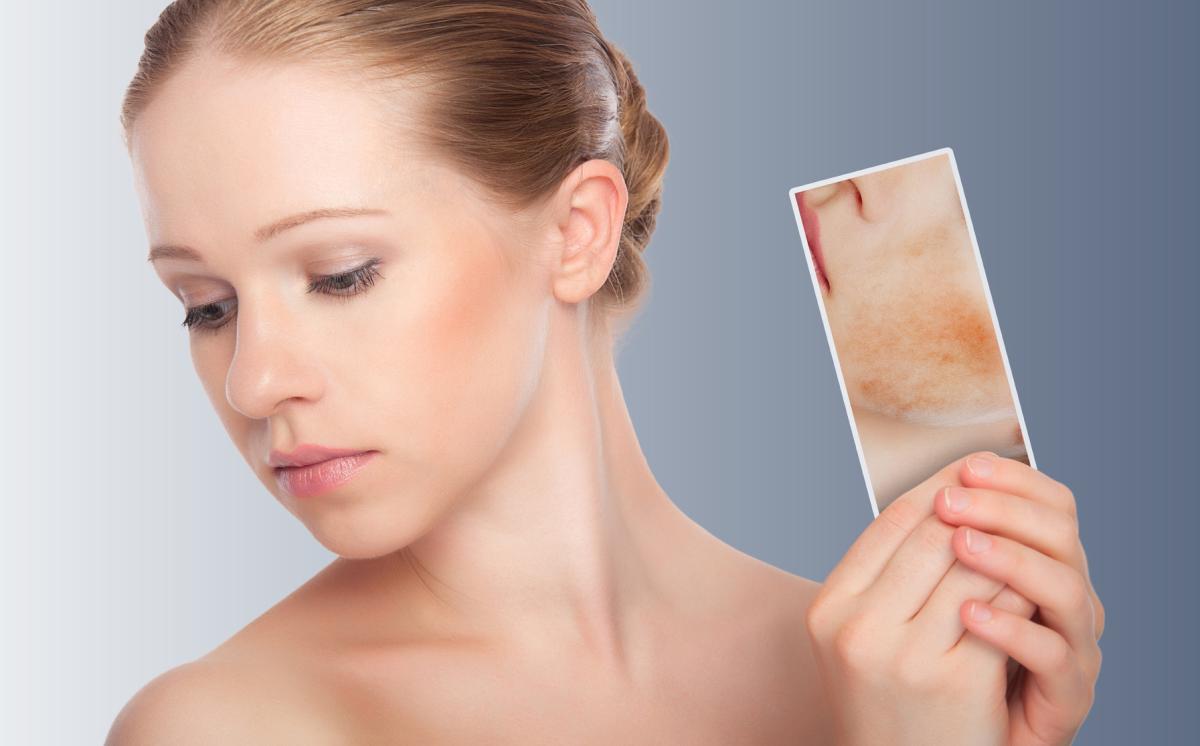  The Pigmentation Disorders Treatment Market: Advancements and Outlook