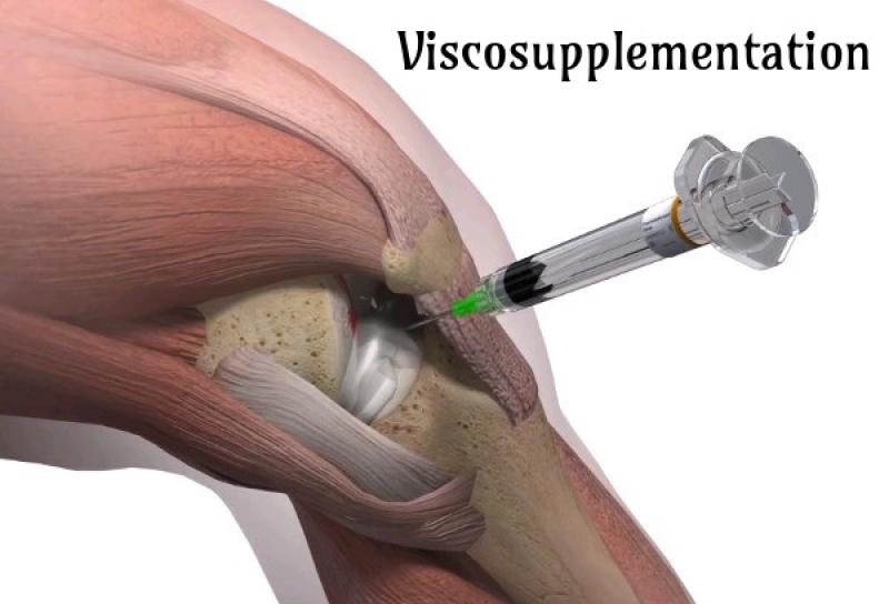 The Science Behind Viscosupplementation