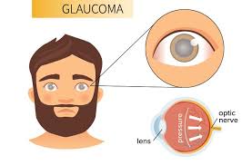 Best Hospital For Glaucoma Treatment
