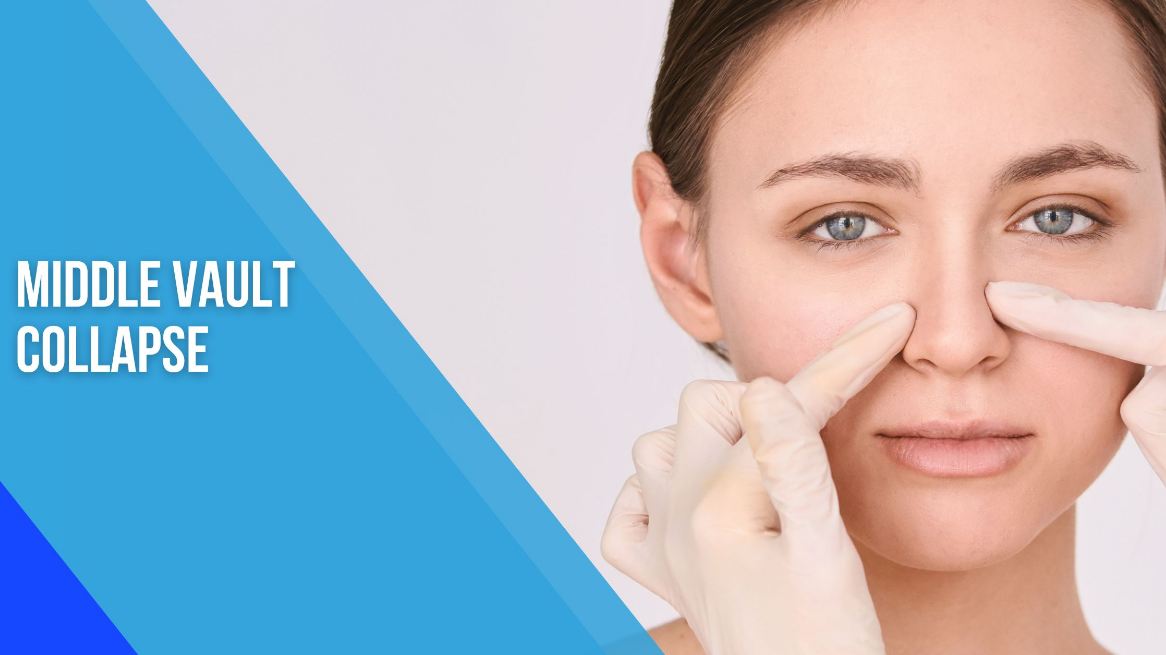 Nasal Valve Surgery for Breathing Improvement: Symptoms, Treatment, and Recovery