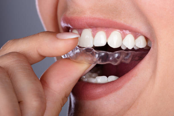 Adult Braces and Beyond: Locating the Right Orthodontist Near You