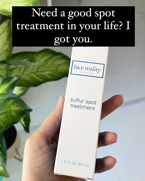 Banish Acne Woes with These 5 Effective and Natural Treatment Options