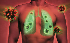 Acute Lung Injury Treatment Market 2022 | Industry Demand, Fastest Growth, Opportunities Analysis and Forecast To 2030
