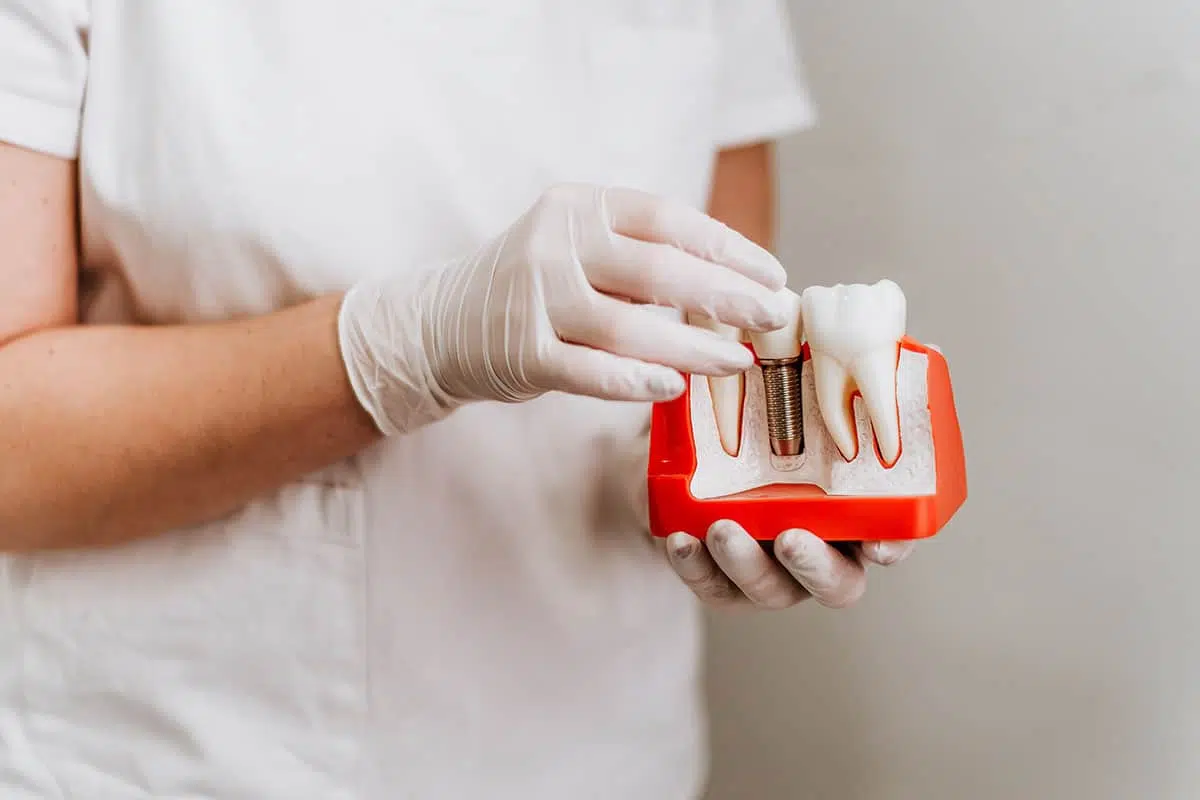 Reclaiming Your Smile with Dental Implants in Lake Mary