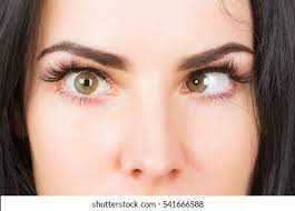 Squint Eye Treatment in Delhi