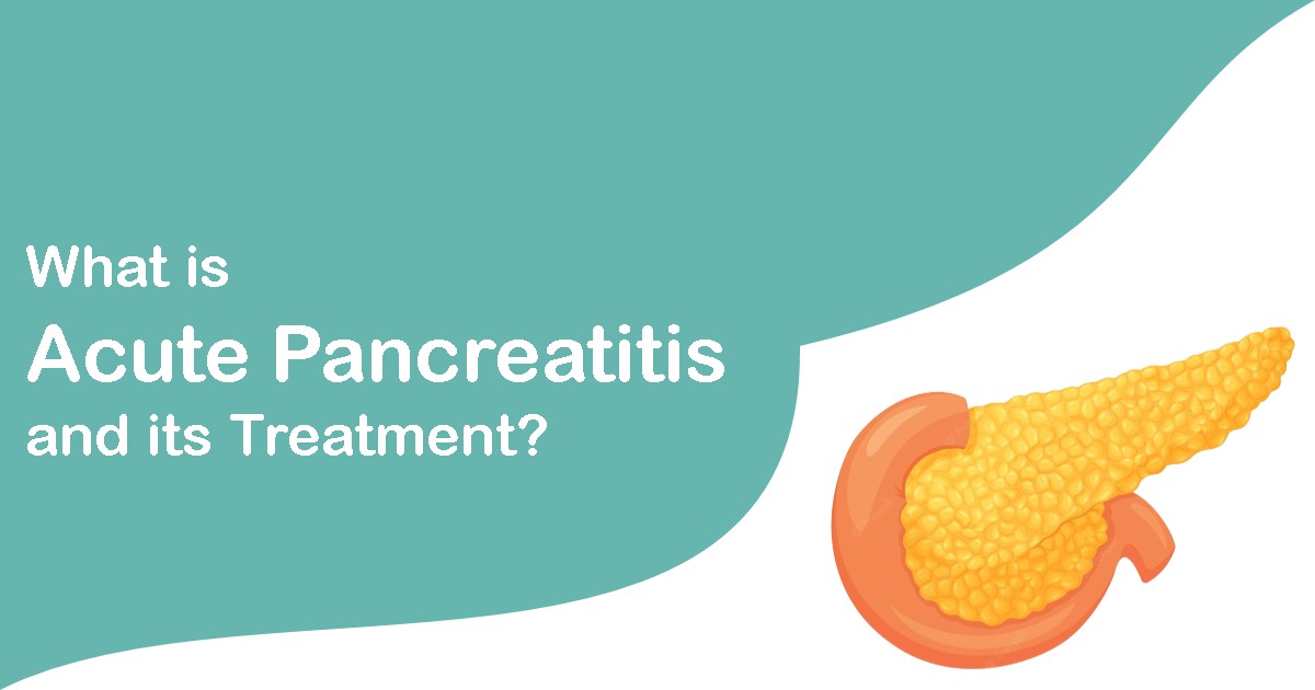 What is Acute Pancreatitis and its Treatment?
