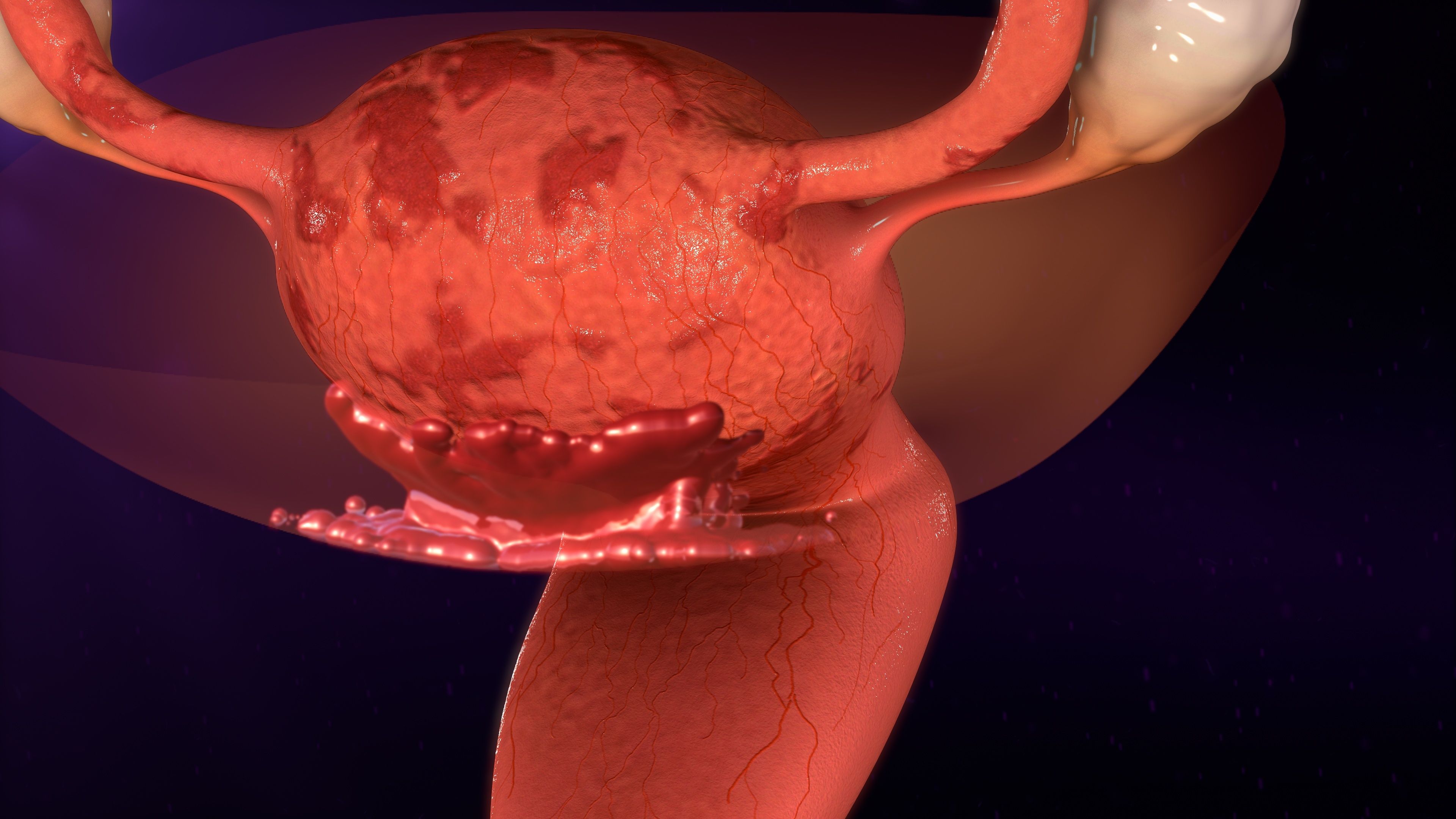 Endometriosis Treatment Market Analysis, Growth, Trends And Forecast 2022-2028