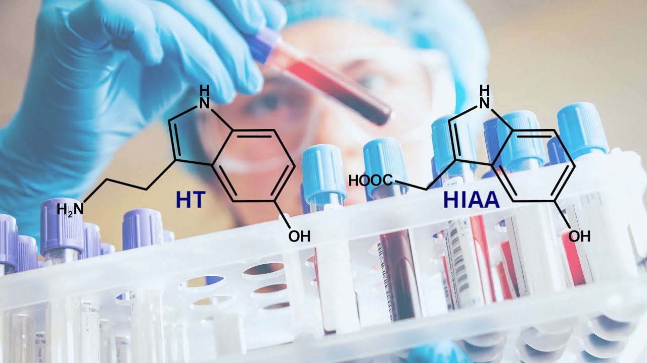 Genomic Biomarker Market Is Estimated To Witness High Growth Owing To Increasing Adoption of Personalized Medicine and Growing Cancer Research Activities