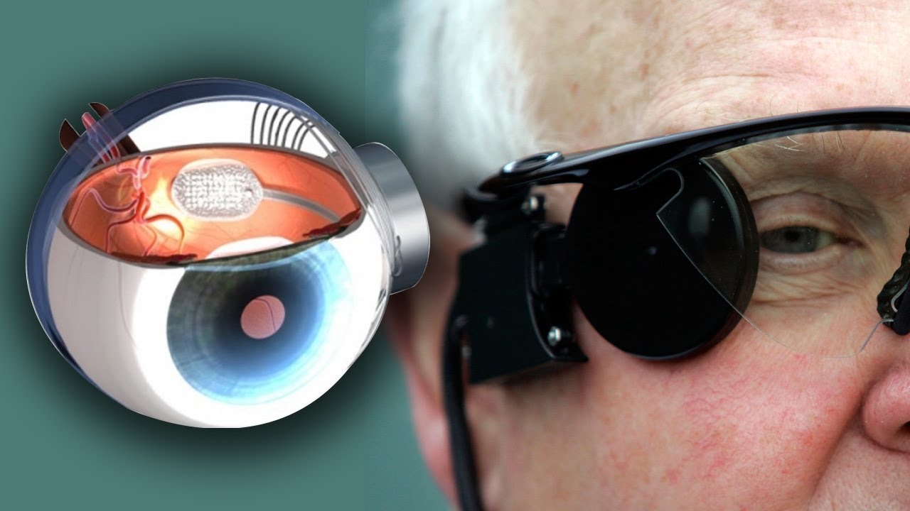 What Artificial Retina Experts Want You to Know
