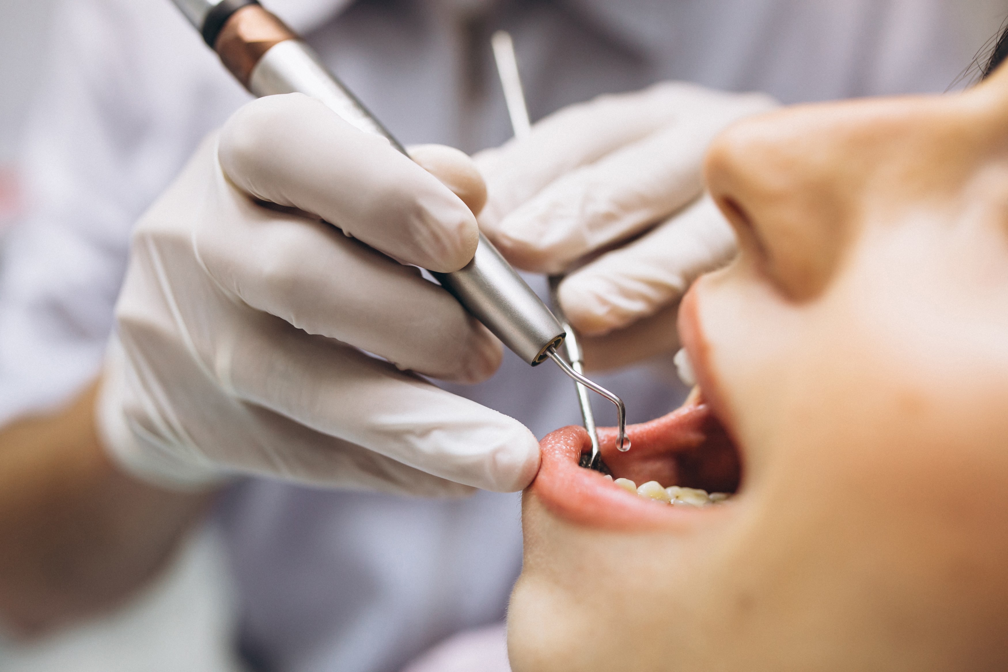 The Significance of Quick Action: Why 24-Hour Dentistry in San Antonio Matters