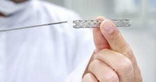 Nitinol Medical Devices Market: Trends and Growth Prospects in 2023 