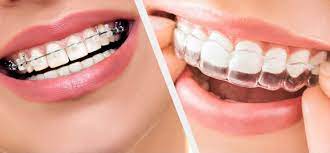 Dental Insurance: A Complete Guide on Coverage and Benefits