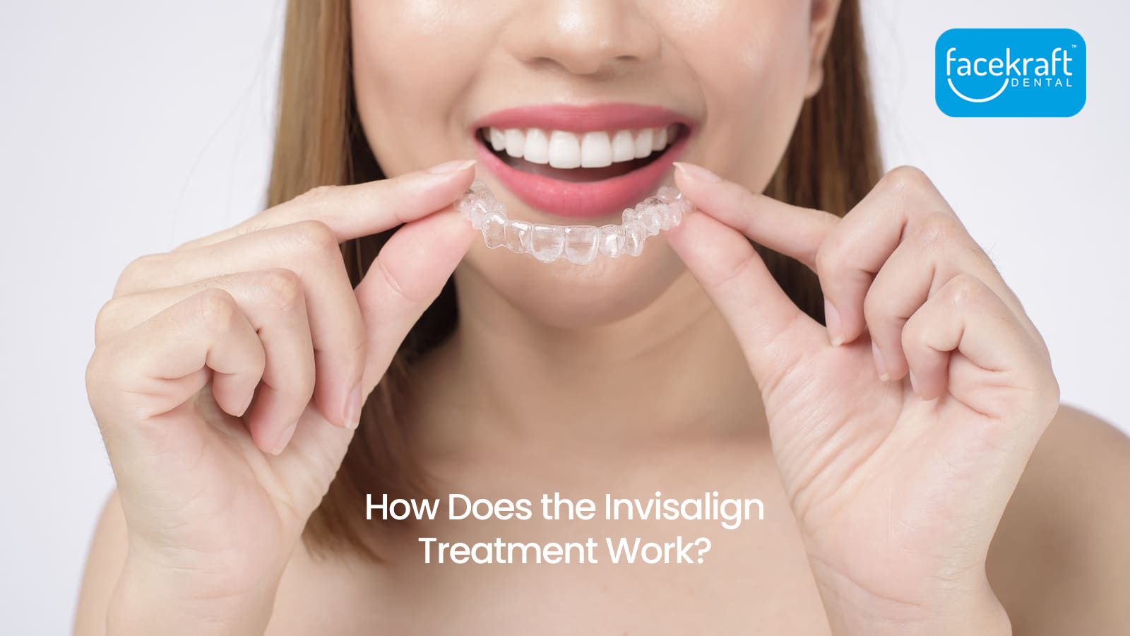 How Does the Invisalign Treatment Work