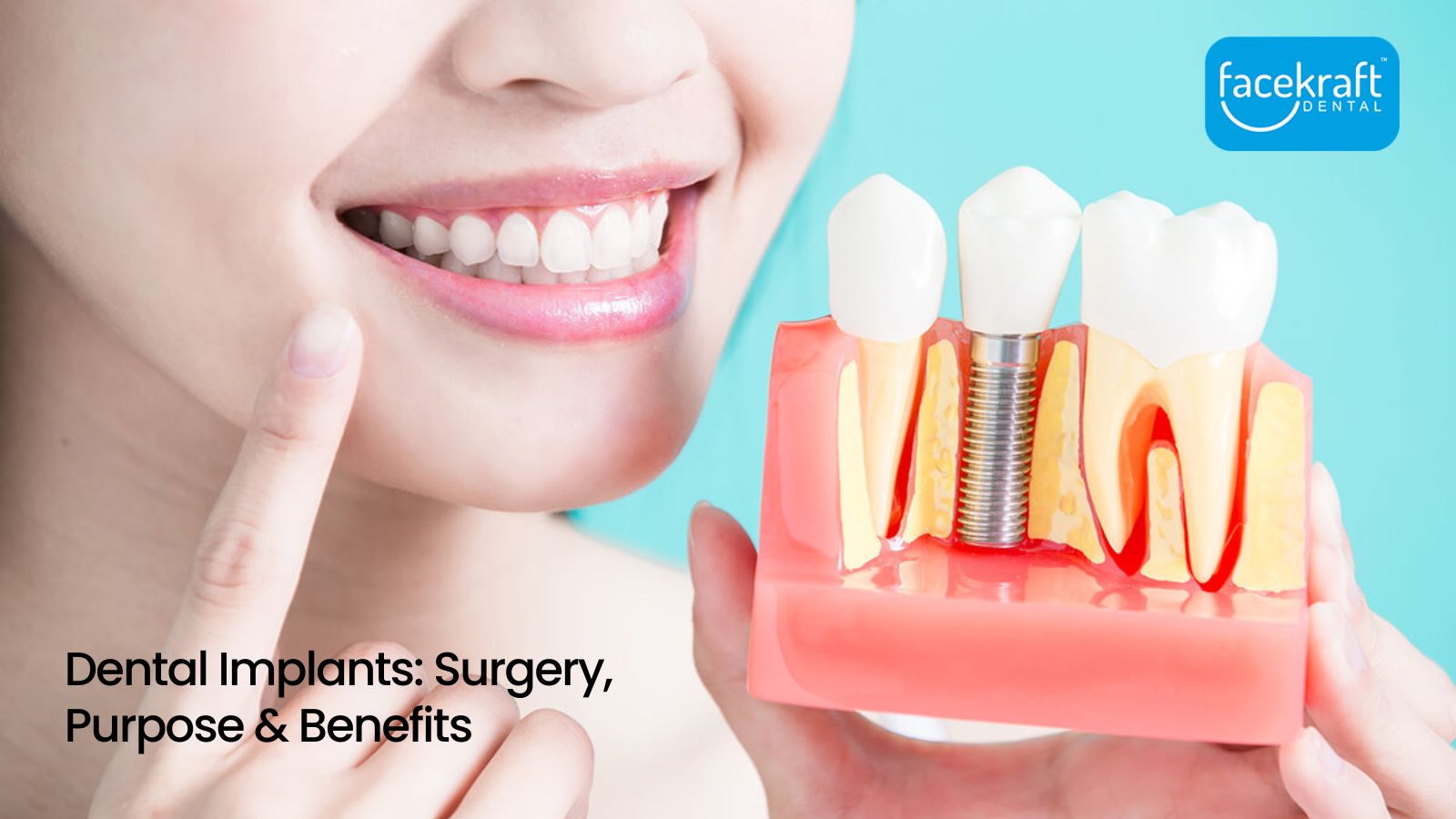 Dental Implants: Surgery, Purpose & Benefits