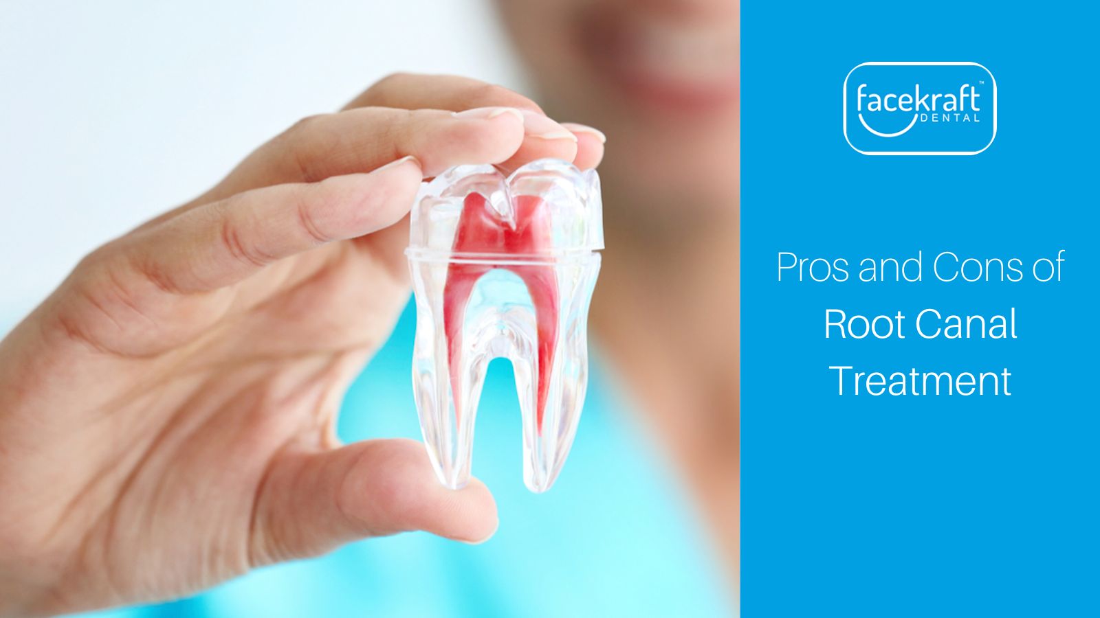 Pros and Cons of Root Canal Treatment
