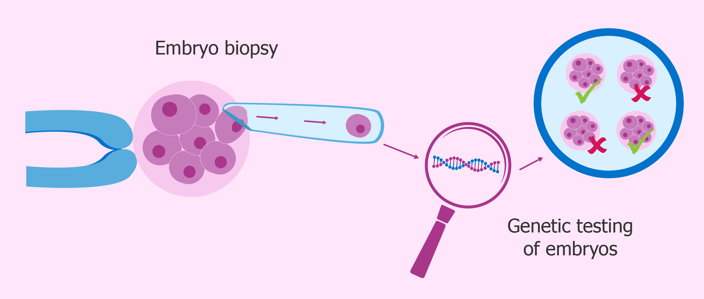 Preimplantation Genetic Testing (PGT) (PGS/PGD) Market will grow at a CAGR of 6.2% Over the Forecast Period