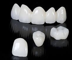 Dental Crown and Bridges Market is Positioned for Outperformance during 2018 to 2025