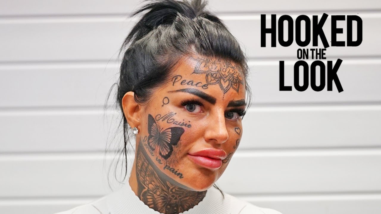 Can face tattoos be completely removed?