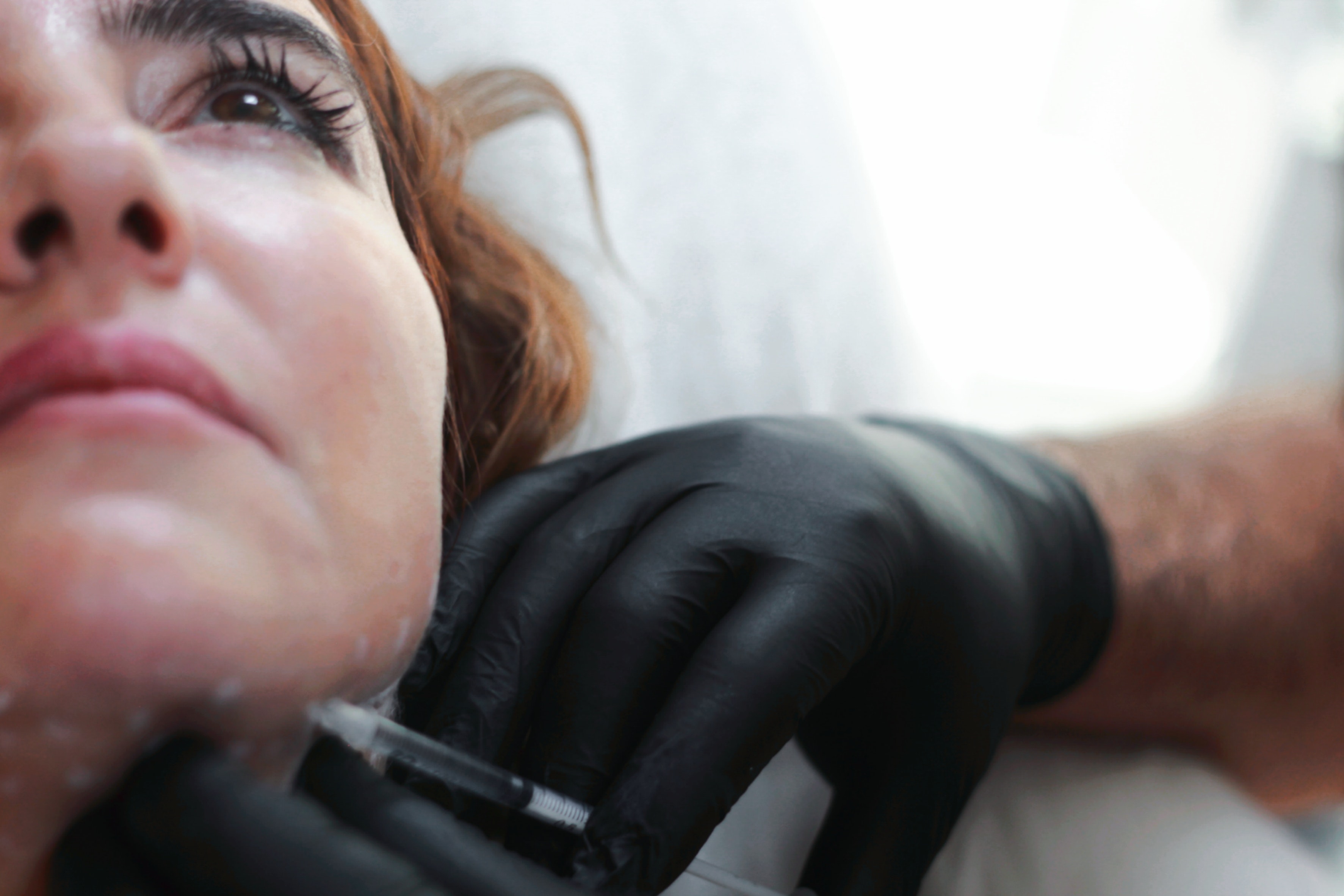 Understanding the Mechanism of Botox and dermal fillers