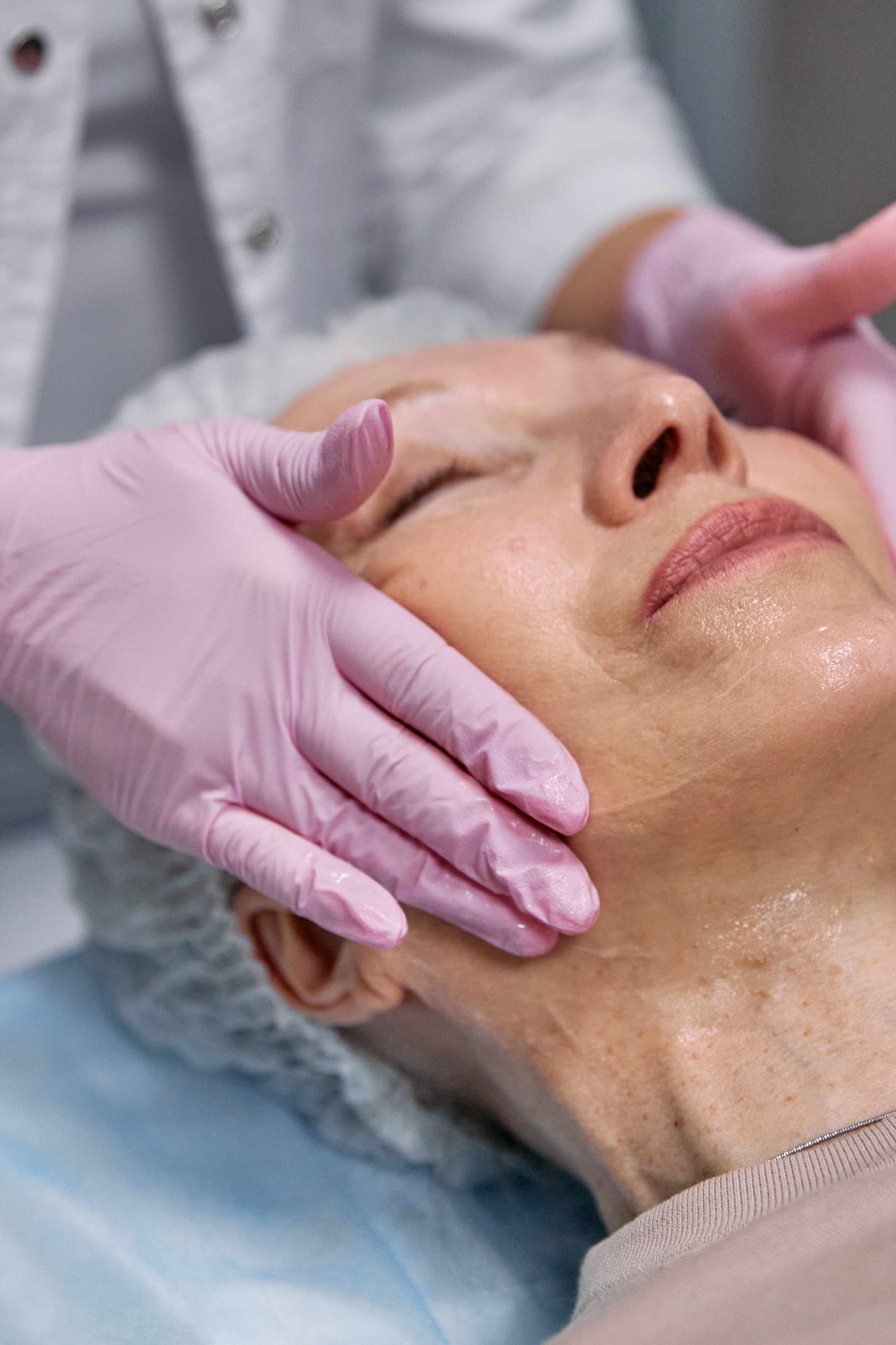 Derma Roller and Thread Lift at Forty Plus: Is It Worth It? 