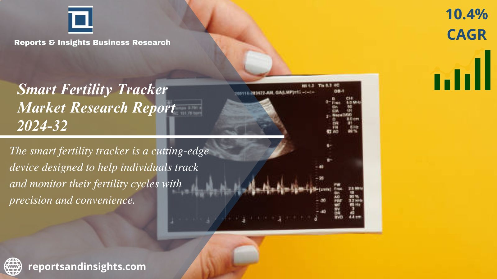 Smart Fertility Tracker Market Size | Forecast Report 2024-2032