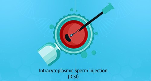 Get the most affordable ICSI Treatment Cost in Mumbai